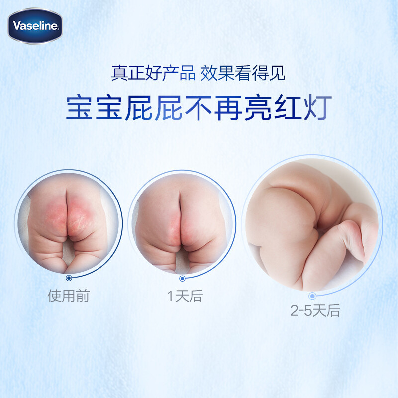 凡士林婴幼儿修护晶冻50g 宝宝润肤身体乳护臀膏 保湿滋润防干裂