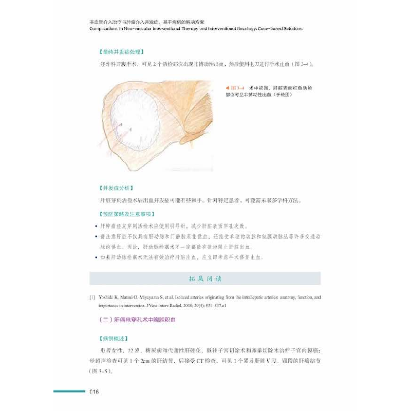 正版新书]非血管介入治疗与肿瘤介入并发症:基于病例的解决方案高清大图