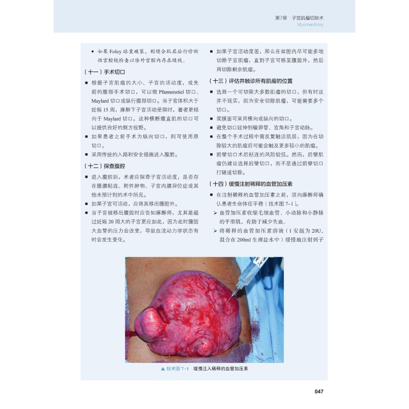 醉染图书妇科手术技巧 妇科学9787504686510高清大图