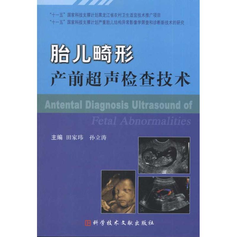【M】胎儿畸形产前超声检查技术-9787502367657