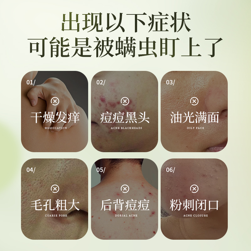 FONCE梵西 除螨皂全身背面部深层清洁男女士去螨虫洗脸沐浴香皂洁面皂 2盒高清大图
