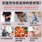 胆囊炎[消除结石]胆囊炎贴胆囊结石腹痛腹胀发烧黄疸恶心想吐 右上腹痛[一盒装]