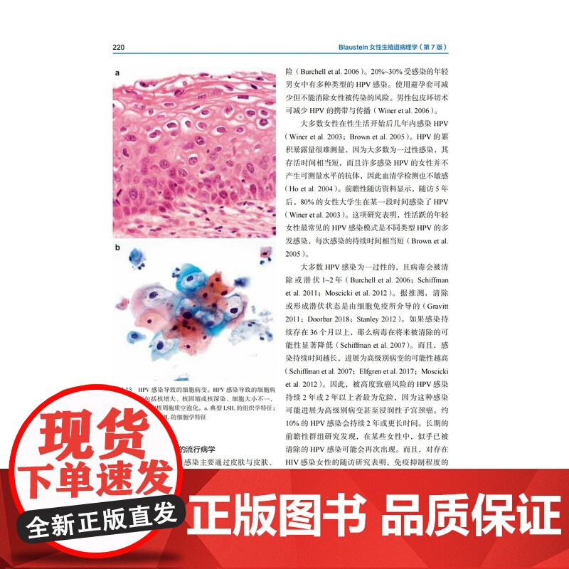 Blaustein女性生殖道病理学 第7版 妇科病理 医学教材 妇科书 教科书 北京科学技术高清大图