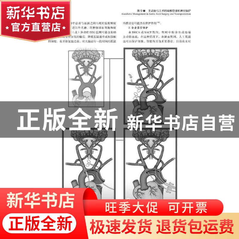正版 围手术期心脏麻醉与外科循证实践高清大图