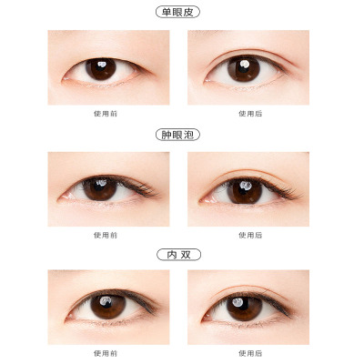 单面 L 肤色 unny双眼皮贴蕾丝隐形女无痕自然肿眼泡单眼皮专用哑光宽型窄型