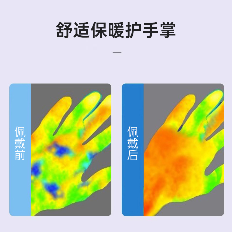 石墨烯医用护腕护掌固定带扭伤手腕腱鞘指关节疼痛运动男女 S码