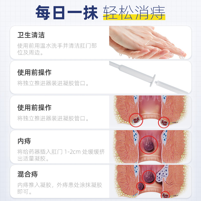 普迈迪卡波姆痔疮膏肉球正品凝胶男女内外混合痔疮膏瘙痒肛裂痔疮5盒共30支