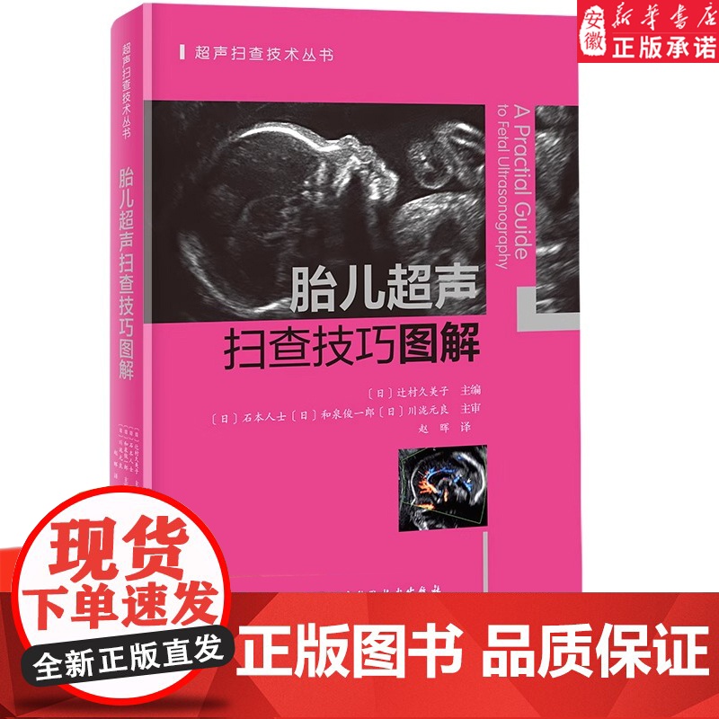 胎儿超声扫查技巧图解 胎儿 超声 扫查技巧图解 覆盖ISUOG孕期筛查全路径实用指导书 胎儿超声波检查 正版书籍高清大图