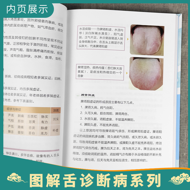 [正版]4本 图解舌诊断病+图解舌诊断病2+图解妇科舌诊断病+图解小儿舌诊与体质 中医临床病症望舌知健康临床实拍彩图人