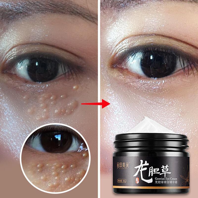 龙胆去除脂肪粒眼霜膏脸油脂粒的克星眼部精华针神仪器黑眼圈去眼袋细纹补水保湿提拉紧致抗皱眼部护理
