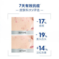 妮维雅NIVEA 男士精华抗痘洁面炭泥150g