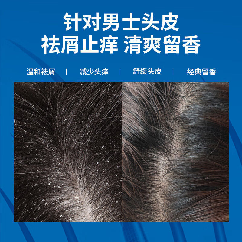 阿道夫 茶树精油男士洗发水(祛屑止痒)450g(1*24) BJDT高清大图