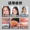 牙齿变白洁牙慕斯去黄漱口水去牙结石牙垢口臭烟牙|买3送2发5盒[一辈子不用愁]拔根款 新款洁牙慕斯[十倍功效]