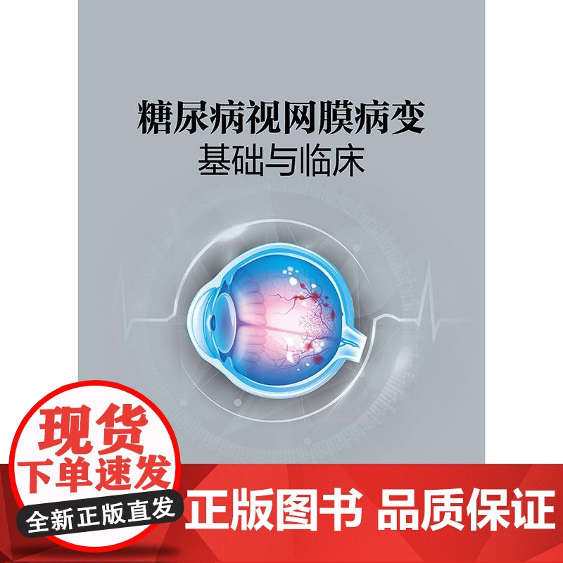 糖尿病视网膜病变基础与临床 2024年12月参考书高清大图