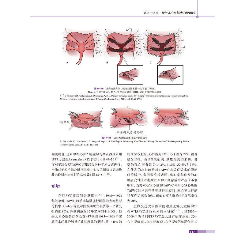醉染图书新生儿外科学(第二版)9787519262471高清大图