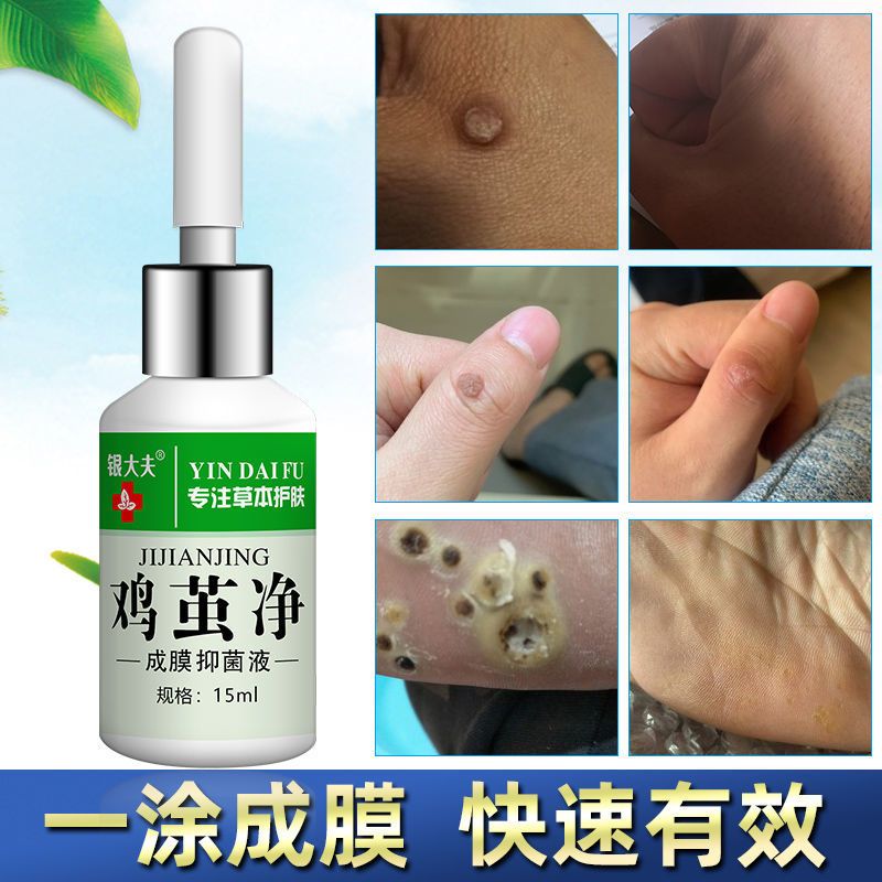 膏鸡眼贴特效鸡眼膏贴无痛去老茧关节茧脚垫祛手足肉刺鸡眼去鸡眼膏