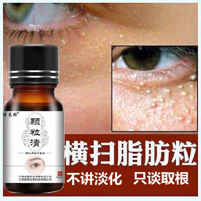 去脂肪粒汗管粒油脂粒神器眼霜祛除眼部黑眼圈脸部颗粒精华液男女 1瓶[送专业棉签]
