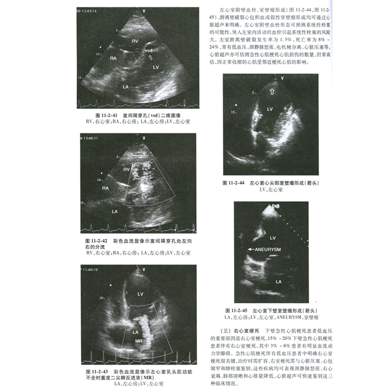[正版]临床实用重症医学第2版第二版刘大为主编 实用重症书籍危重症医学教程急诊医学实用适于重症医学内科学急诊科人民卫生高清大图