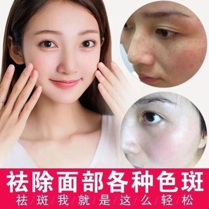 肤研烟酰胺美白祛斑霜去黑色素提亮肤色脸部护肤品男女士面霜1支美白