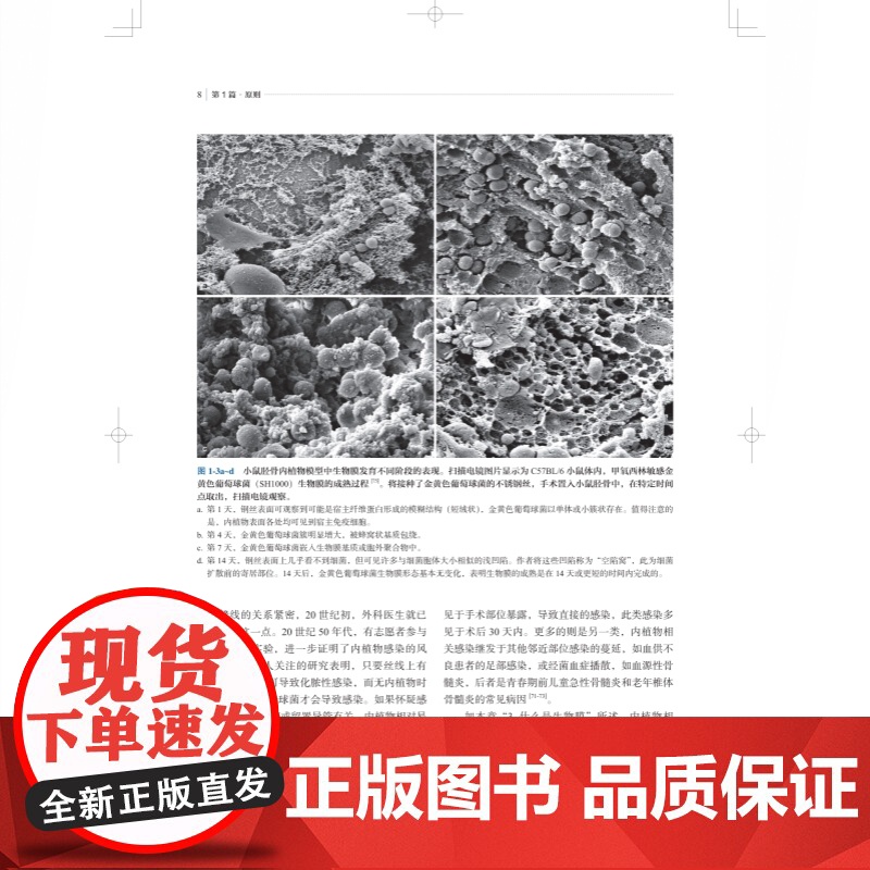 AO骨感染治疗原则 AO系列经典著作医源性感染上海科学技术出版社临床医学外科学 肌肉骨骼系统感染治疗高清大图