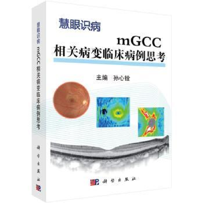 音像mGCC相关病变临床病例思考孙心铨主编
