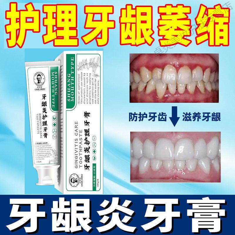 牙龈萎缩最快恢复方法用哪个牙膏