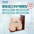 欣曼科教 高级瘘管造口术护理模型XM-H38