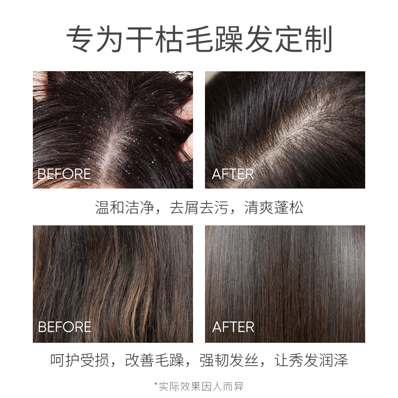 欧贝斯(obeis) 去屑洗发露(营养丰盈蓬松)750ml)高清大图