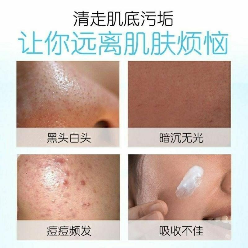 清一毛孔清洁霜100克 送清一绿豆泥小样50克 毛孔清洁霜深层清洁油脂污垢排毒祛痘收毛孔去粉刺去黑头