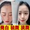 美白祛斑洗面奶淡斑去黄补水保湿去黑头收缩毛孔清洁面乳男女通用