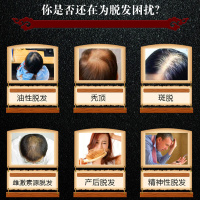 女神秘笈 首乌防脱育发生发液增发密发产品头发增长营养水精华液非洗发水露脂溢性脱发男士女士通用60ML/1盒