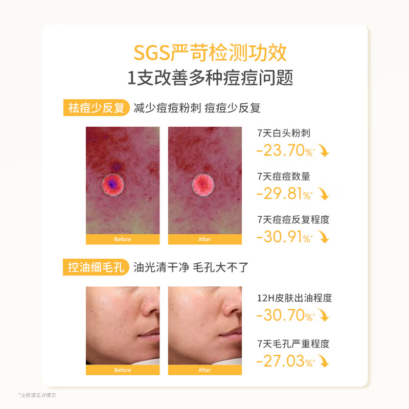 袋鼠妈妈安肌祛痘雪泥洁面乳2.0版-100g 6923687520552高清大图