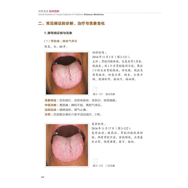 2册 临床实用舌象图谱+观舌配方 [正版] 中医舌诊临床图解 许家佗 舌诊基础知识 舌的组织结构 舌面脏腑分属理论 望舌高清大图