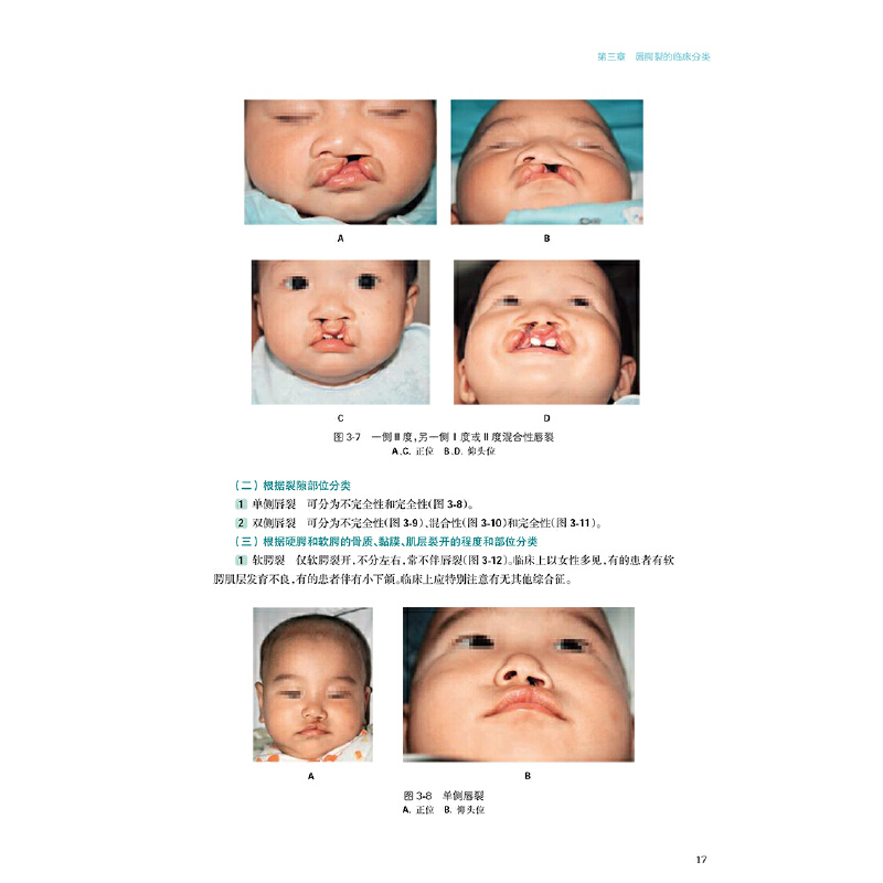 [正版]书籍美容外科学全书——唇腭裂序列治疗学