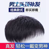 男士头顶真发补发块隐形补发片假发男帅气无痕秃顶短发翻盖补发套 黑色[真发] 补发块