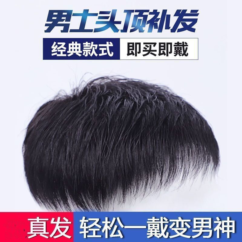 男士头顶真发补发块隐形补发片假发男帅气无痕秃顶短发翻盖补发套 黑色[真发] 补发块