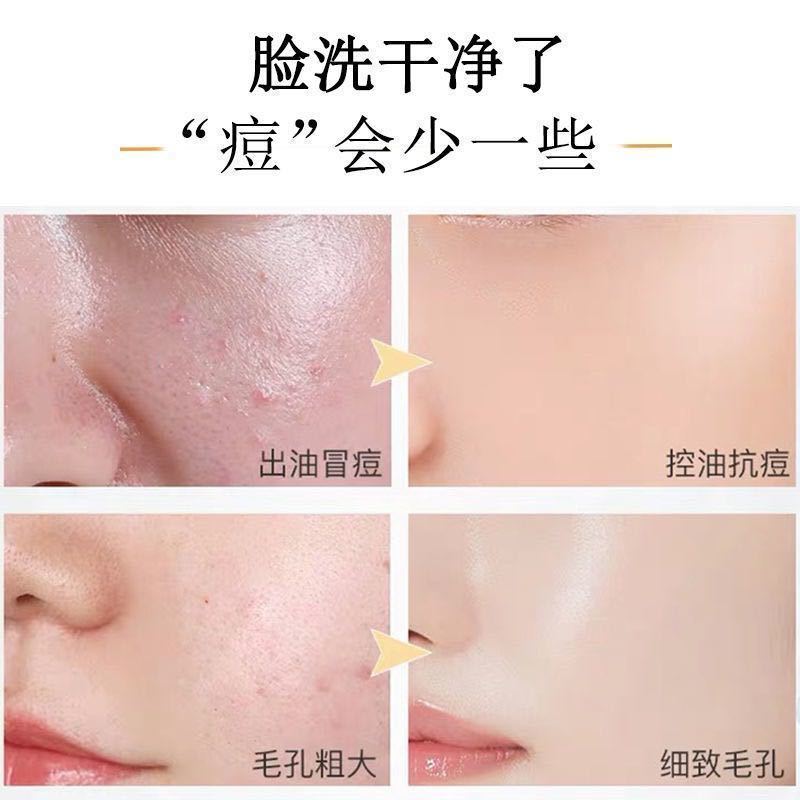 高颜值氨基酸洗面奶美白补水控油祛痘深层清洁收缩毛孔学生洁面乳 胶原蛋白氨基酸洗面奶 1支装[深层清洁]