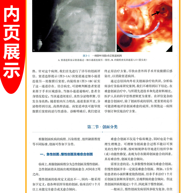 [正版]W 创面修复医师培训教程 临床医学参考书籍 外科学 创伤外科学 主编陆树良 吴敏洁 谢挺 上海科学技术出版社高清大图