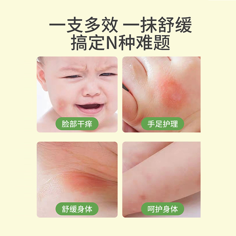 洁宜佳 紫草膏 6g*3支 婴儿专用宝宝儿童蚊子蚊虫叮咬止痒驱蚊旗舰店正品