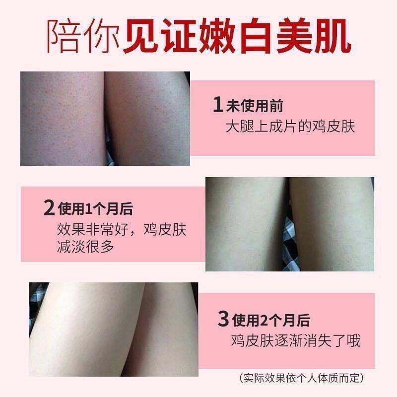 [永久去鸡皮]李佳琦推荐乳木果身体磨砂膏去角质去疙瘩嫩白全身 一瓶送刮板[亏本抢188瓶]