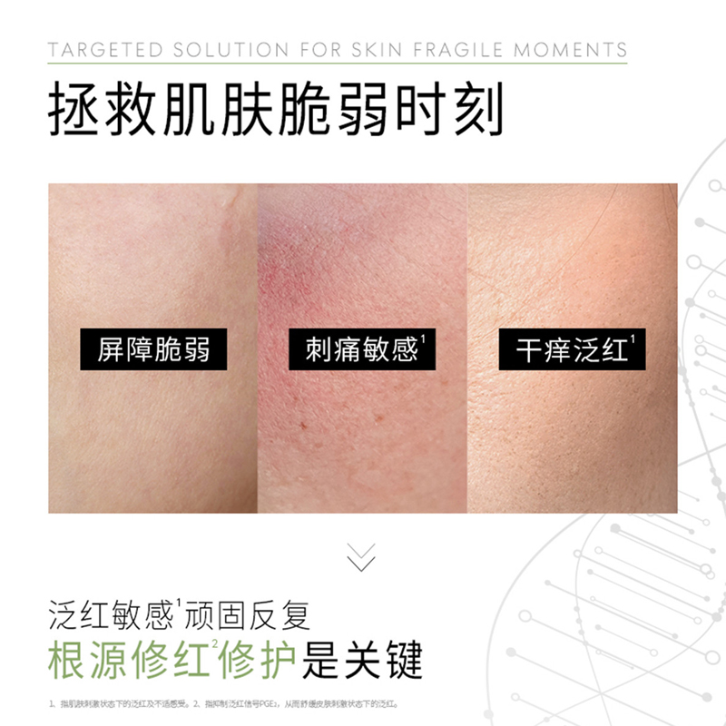 玉兰油(OLAY)修红特护水乳中样旅行装 舒缓修护补水润肤护肤品套装女高清大图
