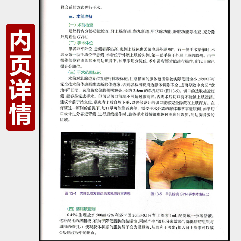 [正版] 腔镜乳腺外科手术操作要领与技巧 主编张忠涛 妇科疾病临床案例诊治教程 外科学参考工具书籍 人民卫生出版社978高清大图