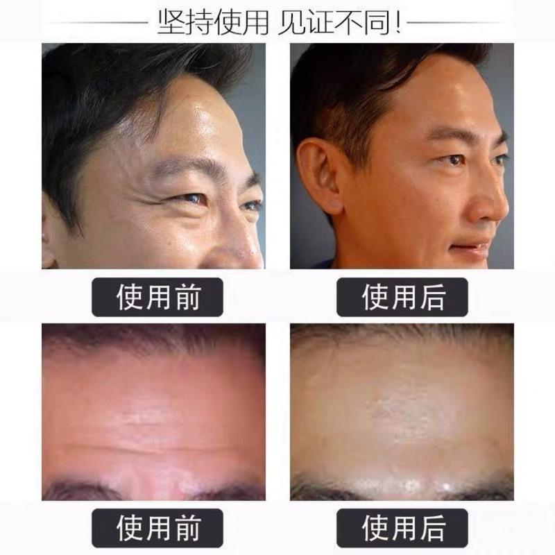 南京同仁堂绿金家园男士专用抗皱紧致去皱纹抬头纹面霜保湿护肤品 刚发现者使用-轻度皱纹*1 [全新升级]南京同仁堂绿金家园