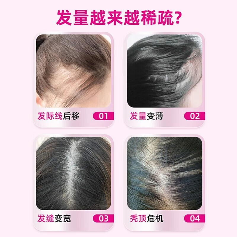 大规格 60ml]达霏欣 米诺地尔搽剂 60ml/盒5%浓度男性型脱发和斑秃米诺地尔生发液 男士米诺地尔旗舰店官方正品