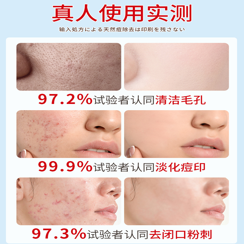 SOCUS海洋主义水杨酸精华液收缩毛孔粗大修复收敛毛孔刷酸祛痘印闭口