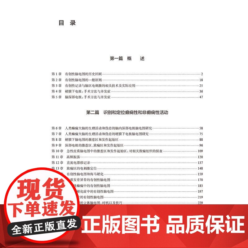 人类癫痫大脑的有创性研究 原理与实践 邵晓秋 张凯 主译 该书系统介绍了癫痫灶和大脑功能区的定位原理和方法等 人民卫生出高清大图
