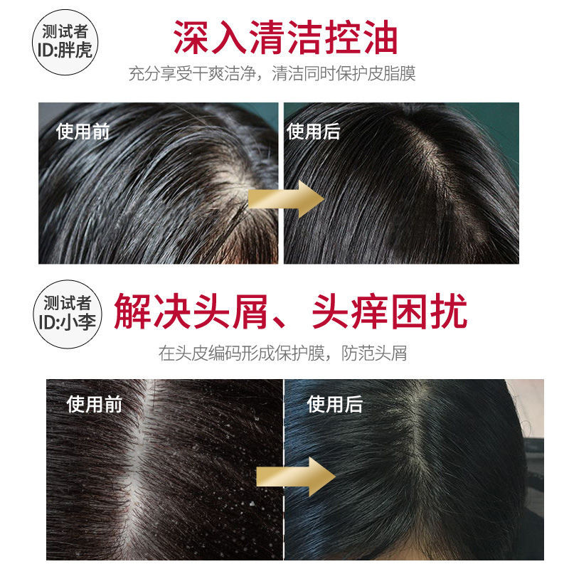 舒蕾绿茶籽控油去屑洗发水500ml+牛奶水润沐浴露650ml高清大图