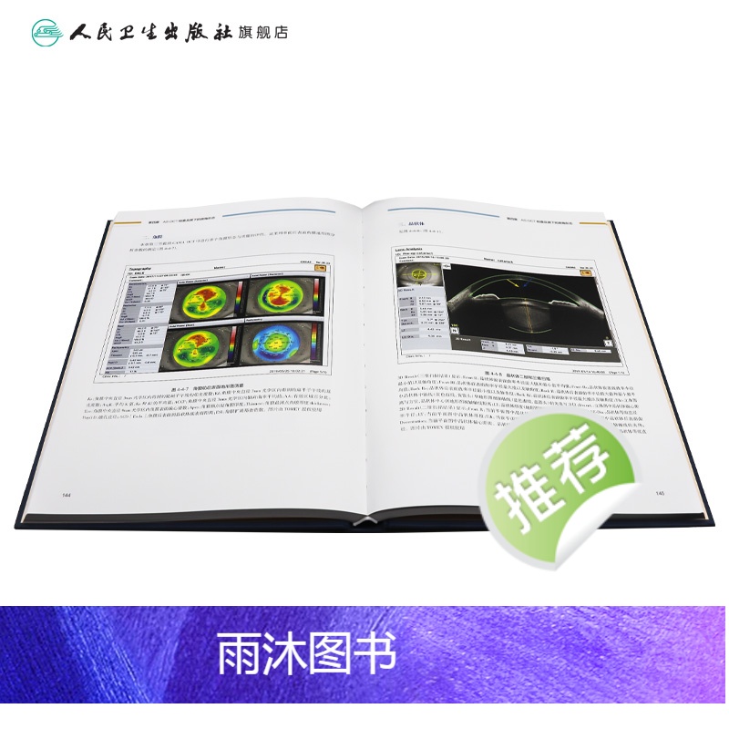 [正版]图解青光眼 眼前节影像学检查及诊断 张秀兰 青光眼诊断 房角镜 UBM OCT 裂隙灯激光虹膜葡萄膜炎人民卫生高清大图