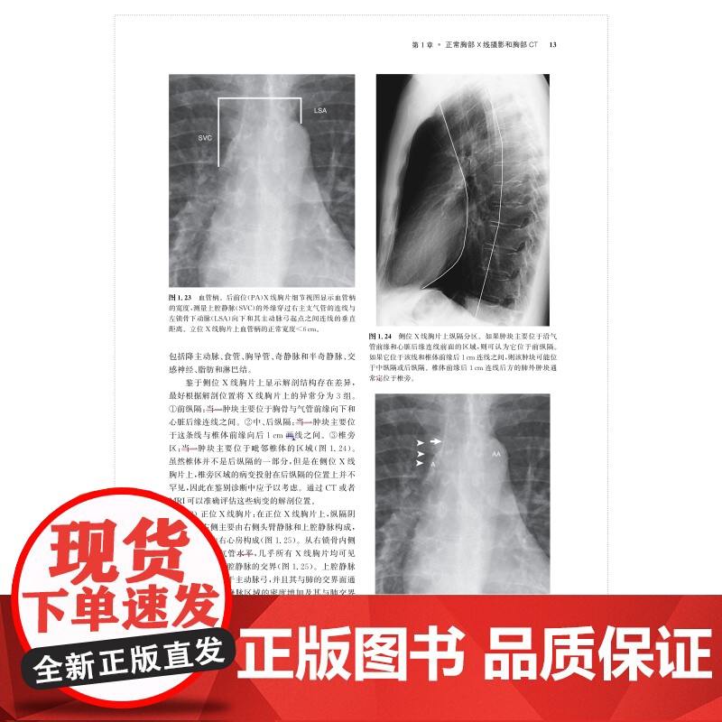 胸部影像学第2版 影像学大师系列上海科学技术出版社影像医学正版工具书高清大图