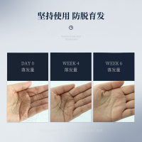 和风雨无硅油防脱发洗发水男士专用去油去屑止痒控油生姜洗头膏液